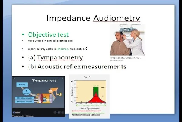 Impedance Audiometry