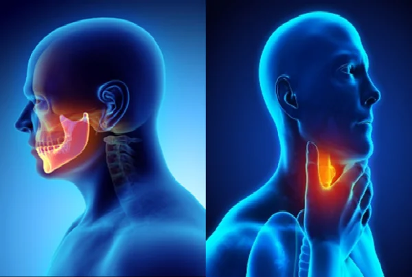 Head and Neck Cancer Treatment