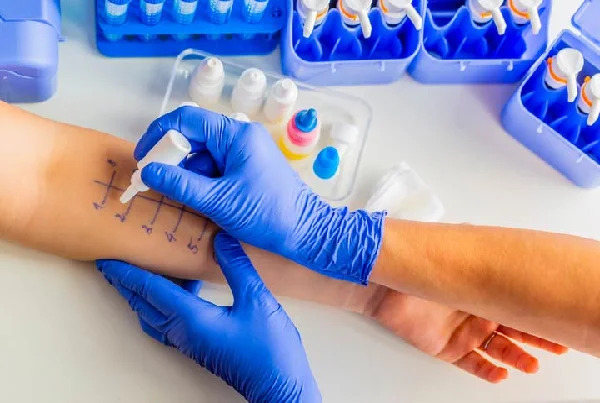 Allergy Test SPT And Immunotherapy